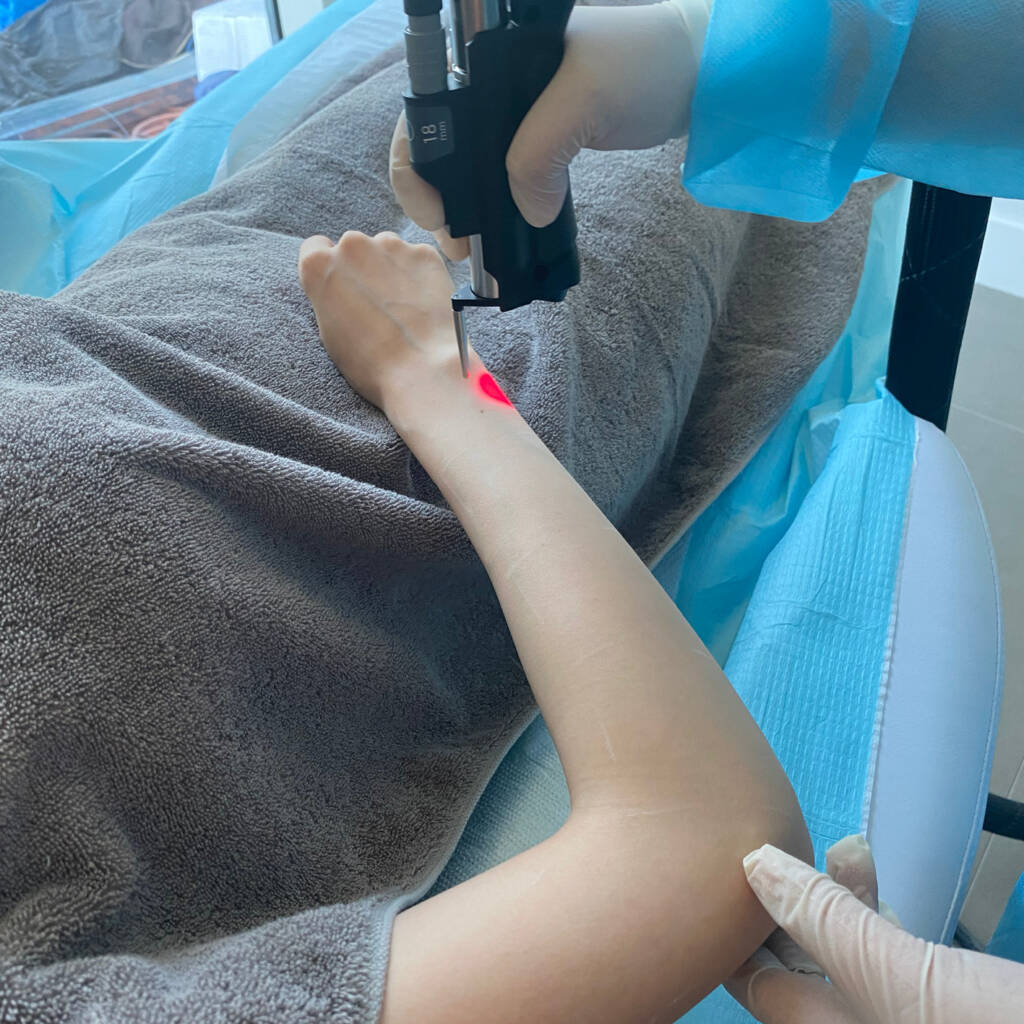 Laser Skin Rejuvenation Laser Hair Removal Kuwait